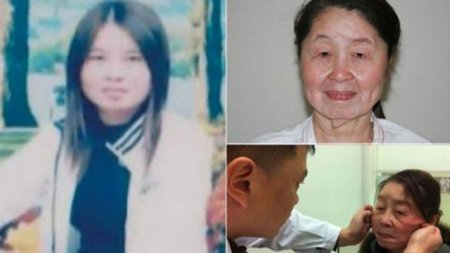 Joven de 28 años en China sufre una extraña enfermedad que la hace lucir como una anciana de 60