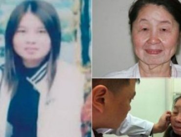 Joven de 28 años en China sufre una extraña enfermedad que la hace lucir como una anciana de 60