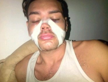 Fotos: Un fanático se realizó múltiples cirugías en el rostro para parecerse a Ricky Martin