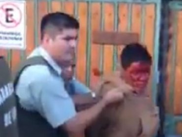 Siguen las detenciones ciudadanas: Brutal golpiza a delincuente en Iquique impacta en la web