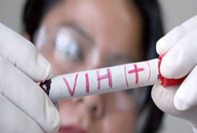 Al menos 105 infectados con VIH por presunta negligencia médica en Camboya