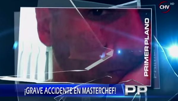 Revelan oculto y grave accidente en grabaciones de "Master Chef"