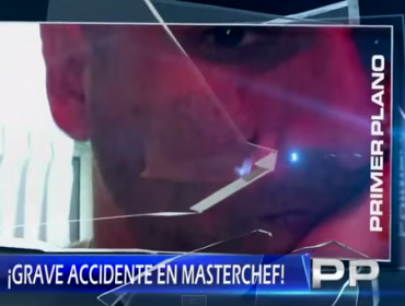 Revelan oculto y grave accidente en grabaciones de "Master Chef"