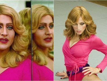 Hombre gasta más de 100 millones para lucir como Madonna