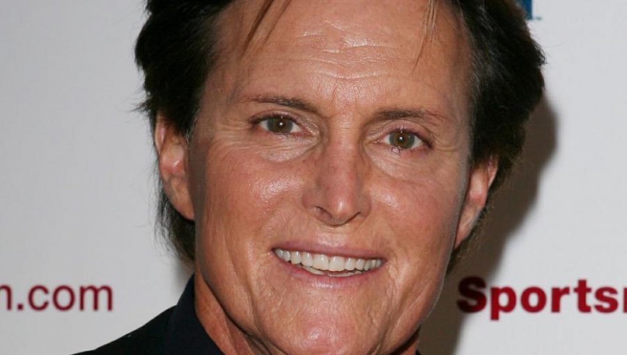 Bruce Jenner confiesa a la policía estar siguiendo un tratamiento hormonal