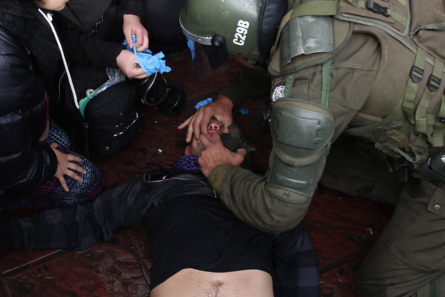 Sigue en estado grave estudiante herido en manifestación de Valparaíso