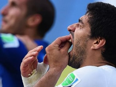 Chiellini sobre el reencuentro con Suárez: El mordisco ya está olvidado