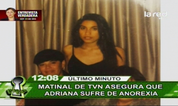 Alejandra Valle revela impactante imagen de cuando sufría anorexia