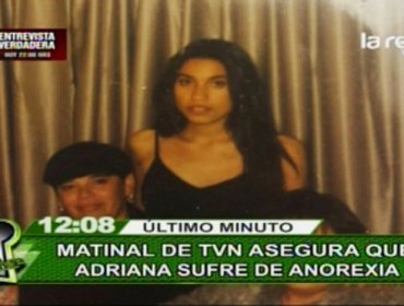 Alejandra Valle revela impactante imagen de cuando sufría anorexia