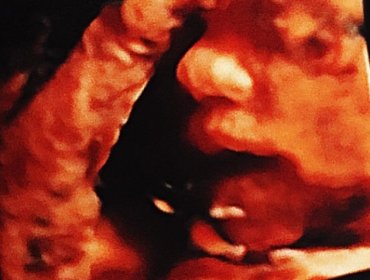 Mira la nueva ecografía que compartieron Faloon y Jean Paul Pineda en redes sociales