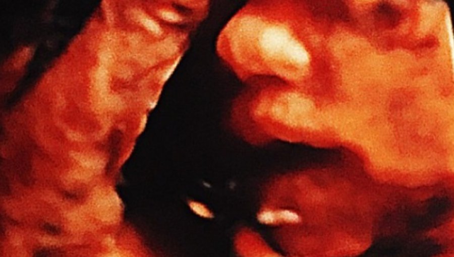 Mira la nueva ecografía que compartieron Faloon y Jean Paul Pineda en redes sociales