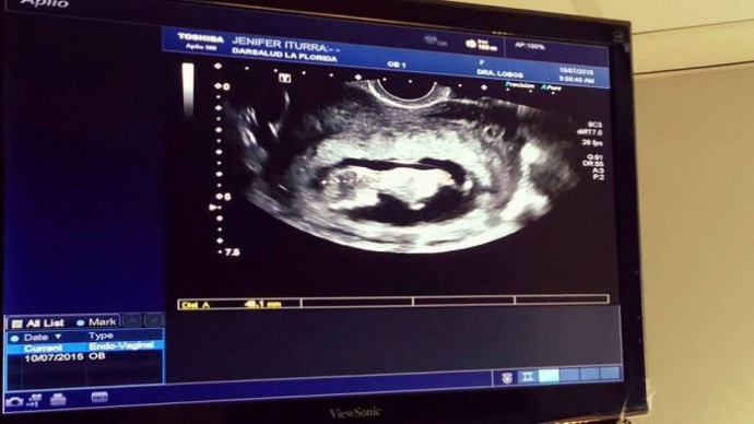 Ex chica Yingo muestra su embarazo