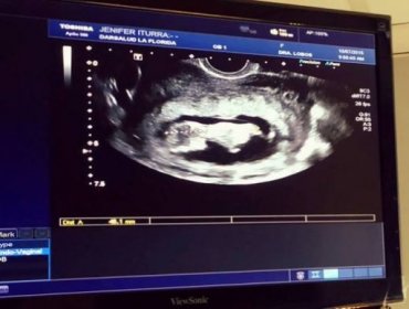 Ex chica Yingo muestra su embarazo