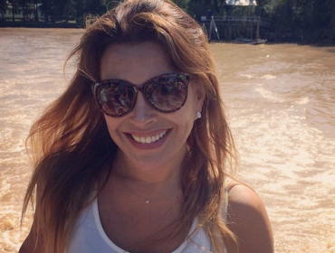 Rostro de Carolina Arregui nuevamente impacta por exceso de cirugías