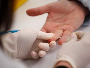 Día Mundial de la Hepatitis: Conoce los síntomas y las medidas de prevención