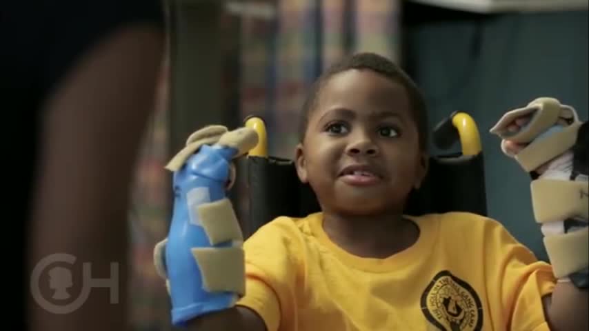 Video: Zion Harvey, el primer niño en recibir un trasplante de manos