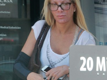 Irreconocible: Actriz de “Beverly Hills, 90210″ sorprende con demacrado rostro
