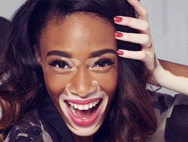 Maquillarse como la modelo con vitíligo, la nueva tendencia en Instagram
