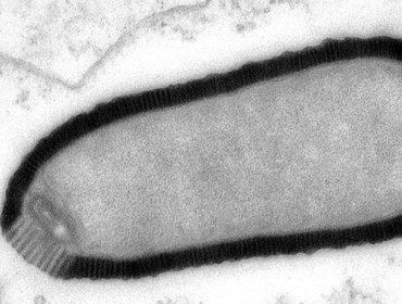 Descubren un virus gigante desconocido en el suelo congelado de Siberia