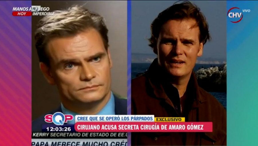 ¿Qué se hizo en la cara Amaro Gómez-Pablos?