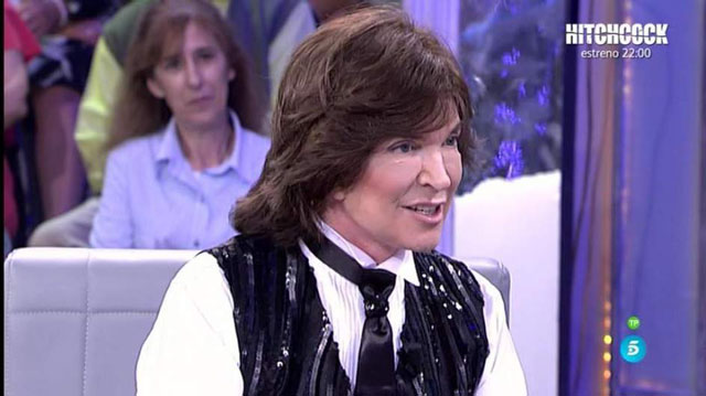 Camilo Sesto reaparece y causa impacto por su rostro