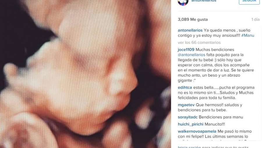 Antonella Ríos comparte ecografía de su bebé