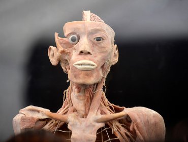 Las sorprendentes imágenes de la exposición de cuerpos humanos “Bodies”