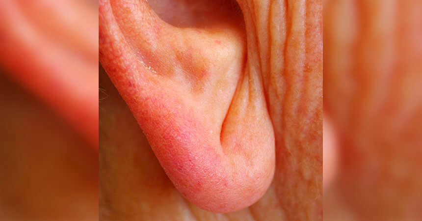 Atento con estas pequeñas imperfecciones en tu oreja que pueden ser una señal de que no estás bien