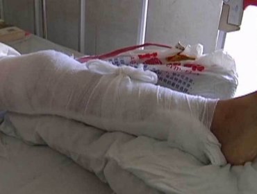 Padre que llegó con su hijo fracturado a hospital fue detenido y será investigado