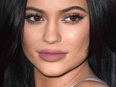 El drama tras los labios de Kylie Jenner