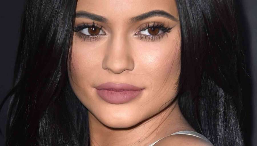 El drama tras los labios de Kylie Jenner