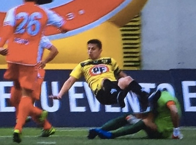 Video: Arquero de Unión Calera quedó inconsciente en cancha y sufrió TEC cerrado