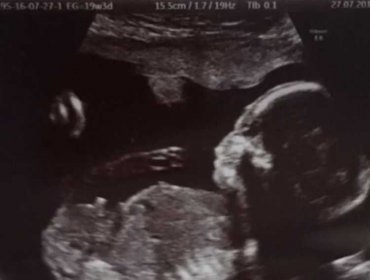 Faloon Larraguibel confirma embarazo de su segundo hijo