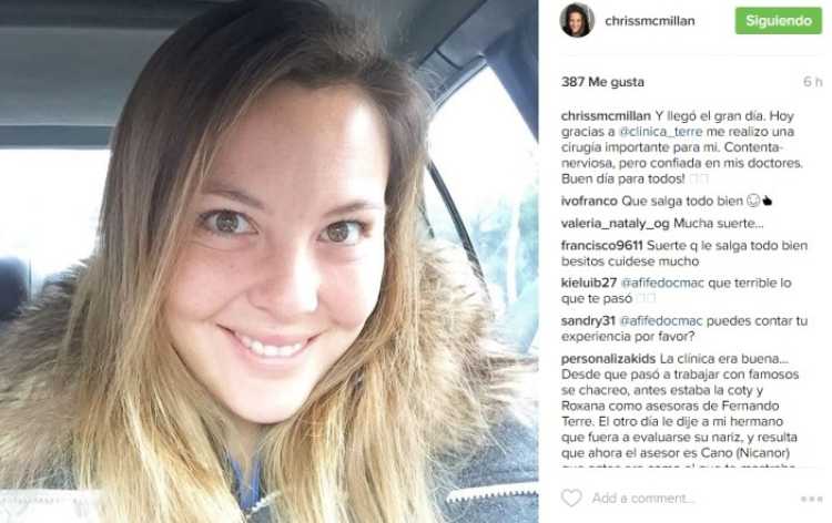 Chriss Mc Millan se realizó cirugía para mejorar su figura