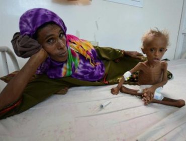 La impactante imagen de un niño que retrata el drama de la guerra en Yemen