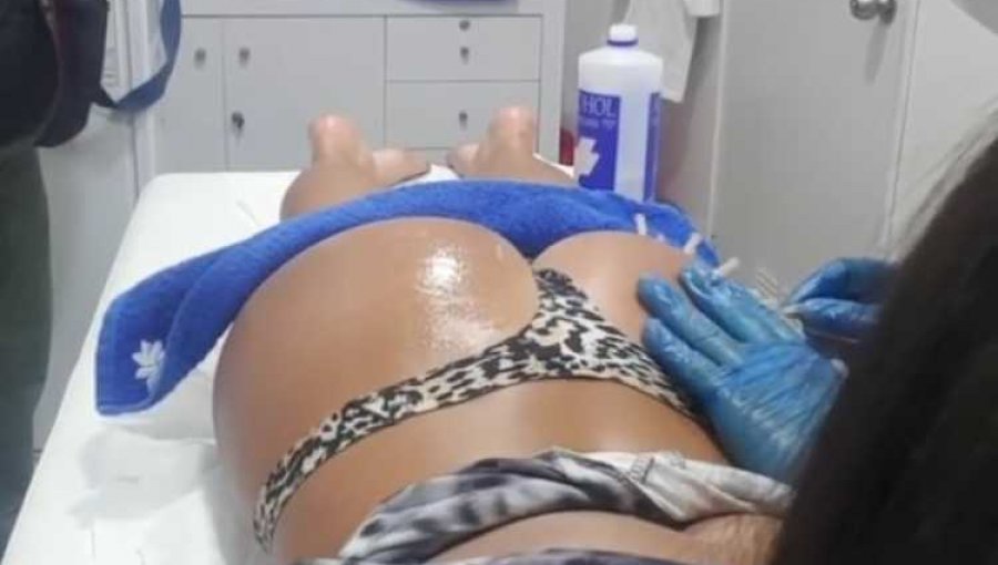 Francisca Undurraga cuenta detalles de nueva operación a su trasero
