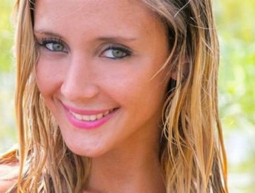 El nuevo rostro de Yuli Cagna tras someterse a tratamiento de belleza