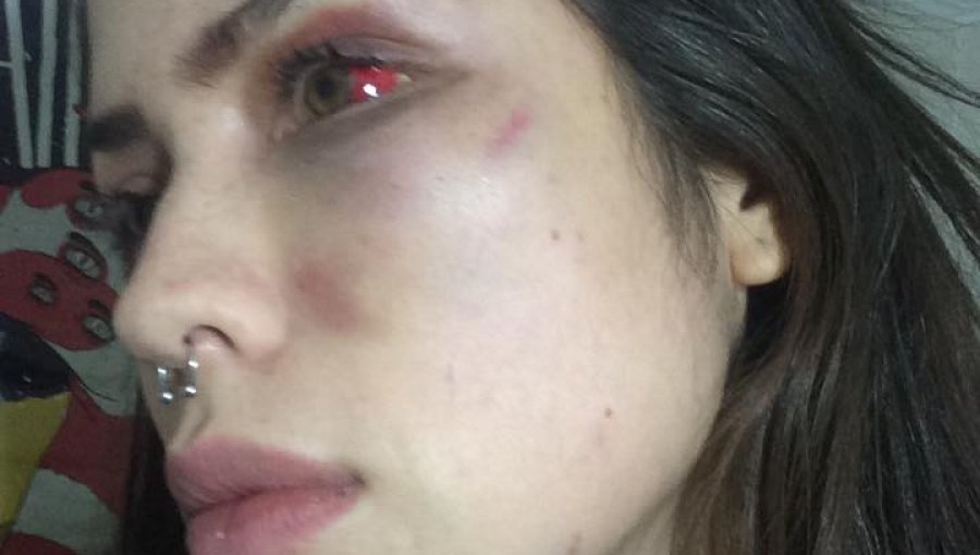 Grave denuncia por brutal golpiza hace pareja de vocalista de Los Tetas