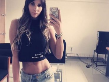 Fotos: Así quedó ex chica reality Fran Undurraga tras someterse a trilipo