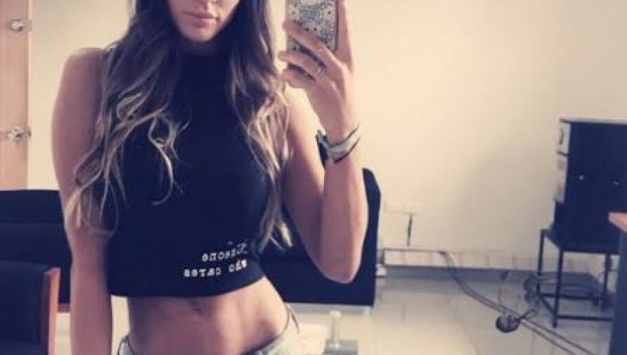 Fotos: Así quedó ex chica reality Fran Undurraga tras someterse a trilipo