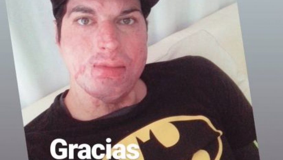 La nueva foto de perfil de Ignacio Lastra: El "youtuber" asume su nueva apariencia y estrena programa
