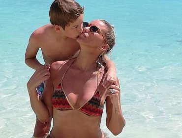 Claudia Schmitd sorprende con foto en bikini tras lipoescultura abdominal