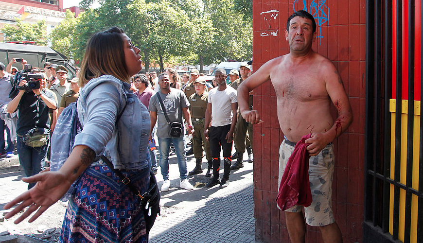 Vendedor ambulante se autoinfirió heridas con un vidrio durante operativo policial en Santiago