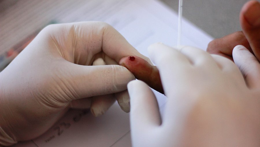 Minsal invirtió $3 mil millones en test para para detectar el Virus Papiloma Humano en mujeres
