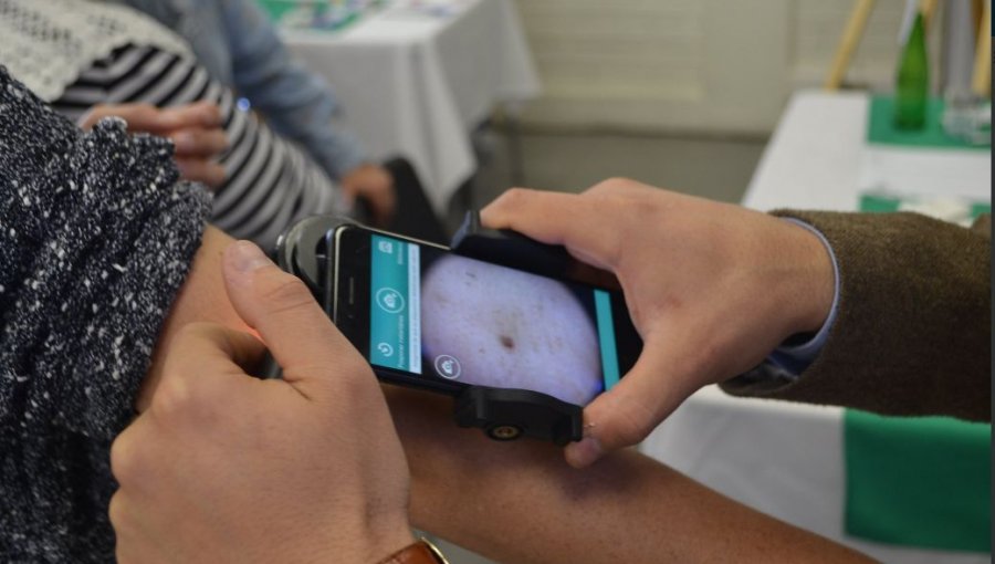 Vecinos de Vitacura se sometieron a test de lunares para detectar cáncer