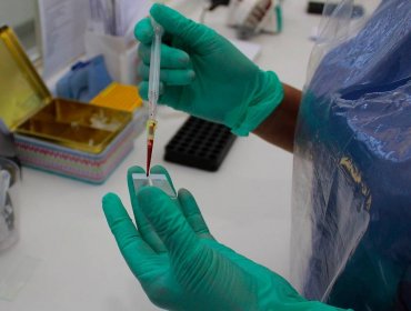Confirman nuevo caso de virus Hanta: Paciente está grave en hospital de Santiago