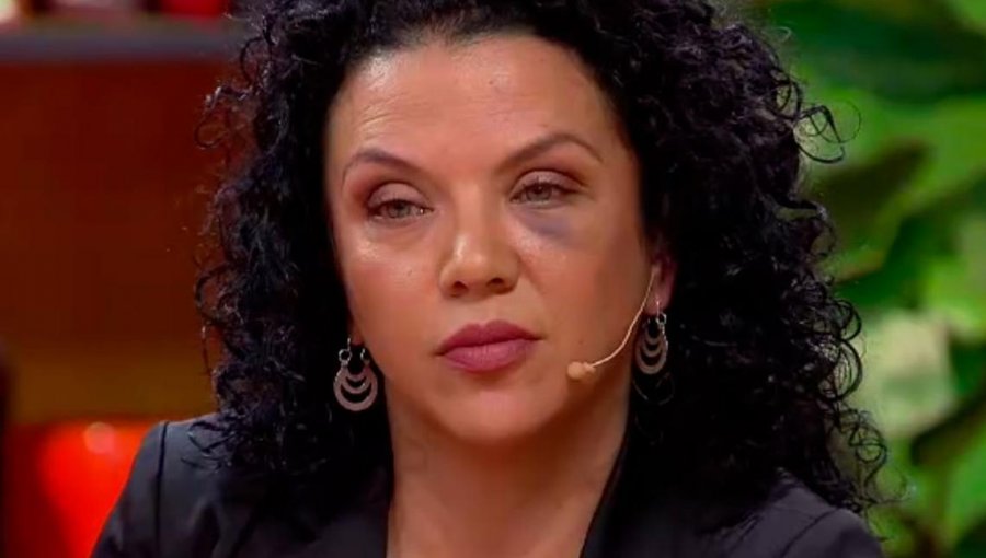 Anita Alvarado se defiende de acusaciones de golpiza contra pareja de ex marido