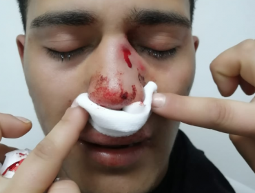 Joven viñamarino denuncia que fue brutalmente atacado por ser homosexual