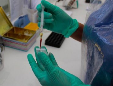 Confirman nuevo caso de contagio de virus Hanta en la región de Los Lagos