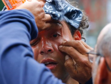 Cuatro detenidos y un herido se registran en incidentes durante manifestaciones en Concepción